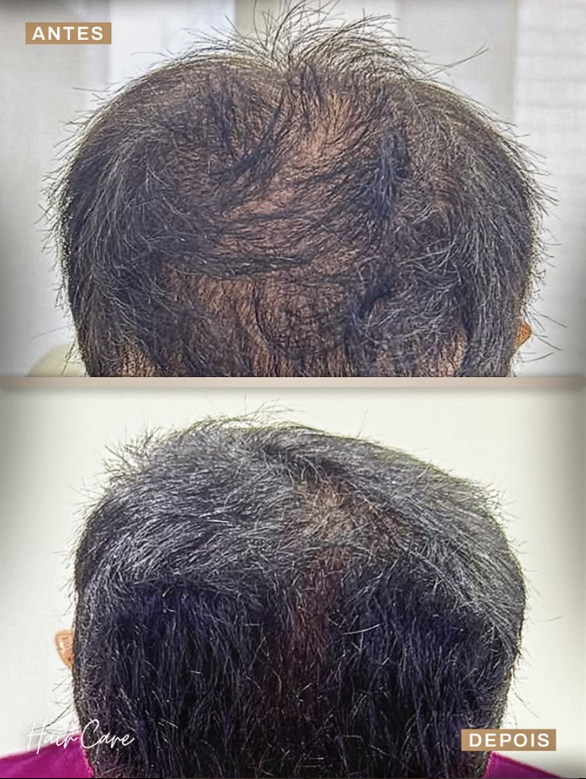 Antes e Depois - Caso 3